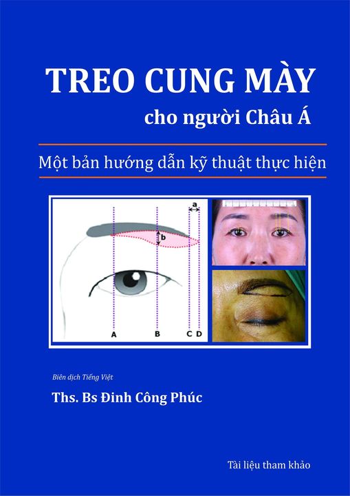 TREO CUNG MÀY CHO NGƯỜI CHÂU Á