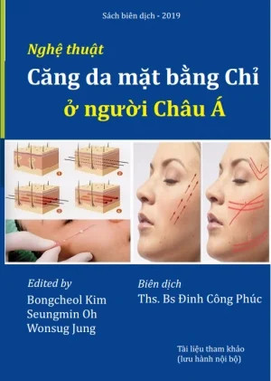 CĂNG DA MẶT BẰNG CHỈ Ở NGƯỜI CHÂU Á