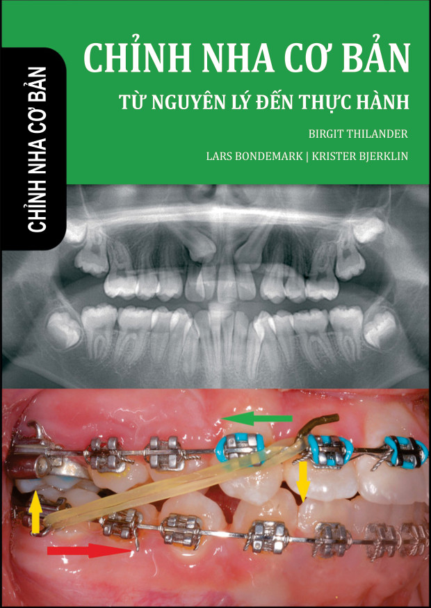 CHỈNH NHA CƠ BẢN TỪ NGUYÊN LÝ ĐẾN THỰC HÀNH