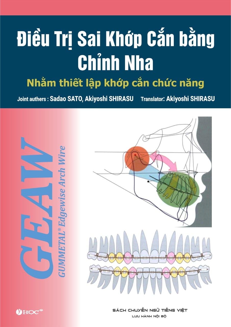 GEAW - Điều trị sai khớp cắn bằng Chỉnh nha