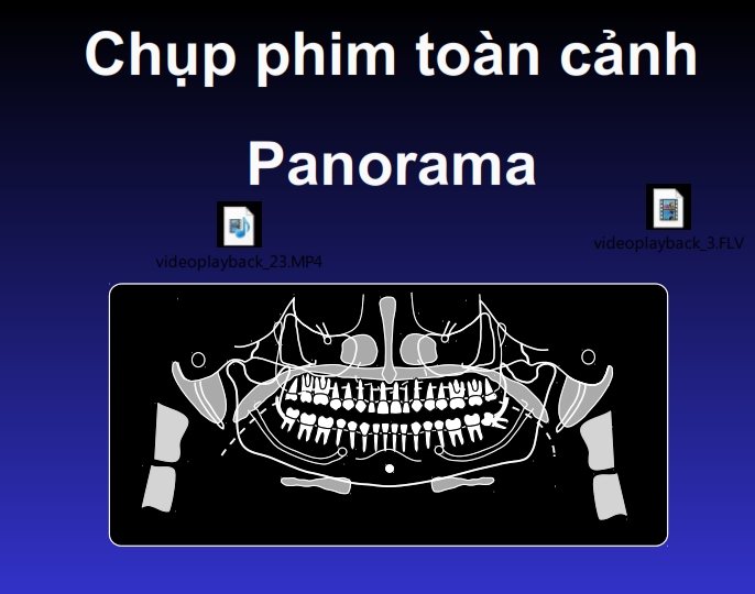 Sách chụp phim toàn cảnh panorama