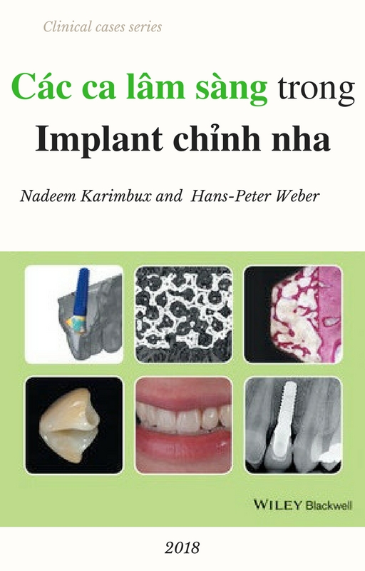 sach-cac-truong-hop-lam-sang-trong-implant-chinh-nha-tieng-viet