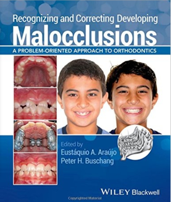 Sách Recognizing and correcting developing malocclusions