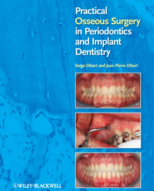 Sách Practical_Osseous_Surgery_in_Periodontics_and_Im