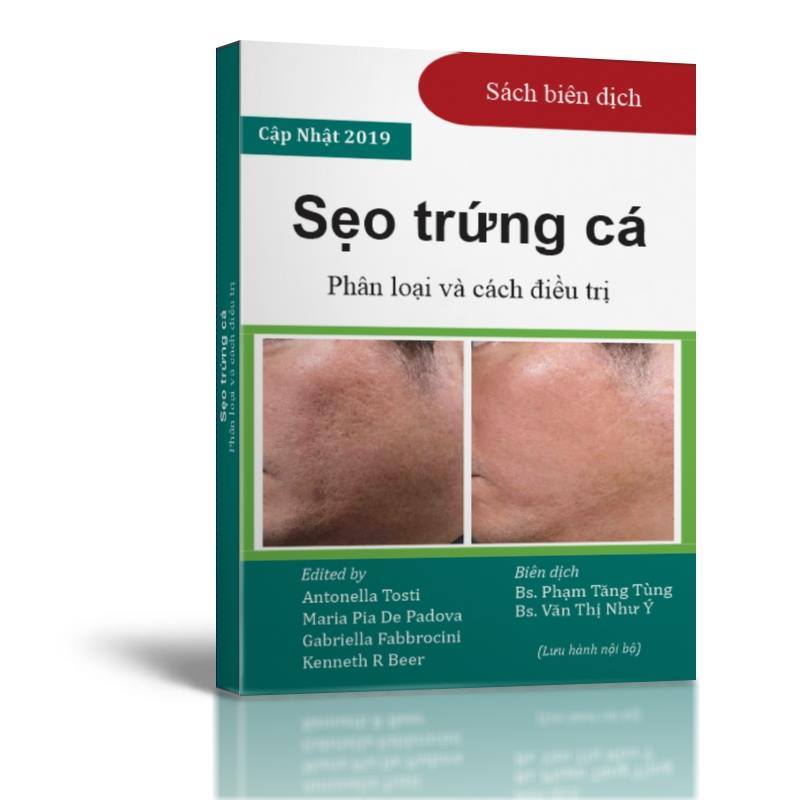 Sách sẹo trứng cá : phân loại và cách điều trị