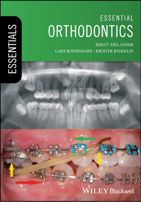 Sách essential Orthodontics 2018
