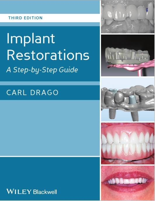 Sách Implant restorations _ a step by step guide-Wiley-Blackwell (2014)