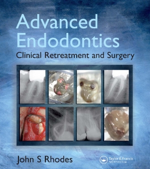 Sách Advanced endodontics clinical retreatment and surgery - taylor francis group 1 edition