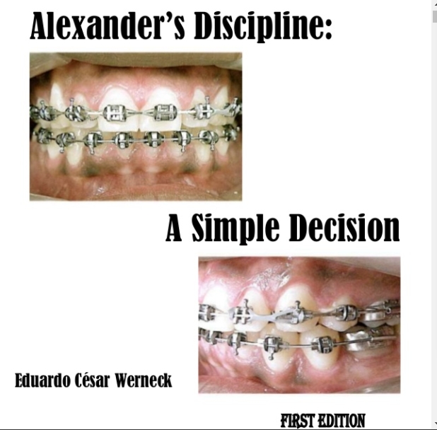 Sách Alexanders Discipline- A Simple Decision - I.E.P.C. Publishing House _ 1 edition