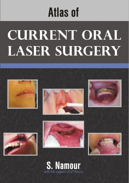 Sách book Atlas of Current Oral Laser Surgery