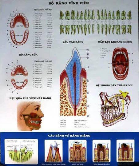 Tranh bộ răng vĩnh viễn