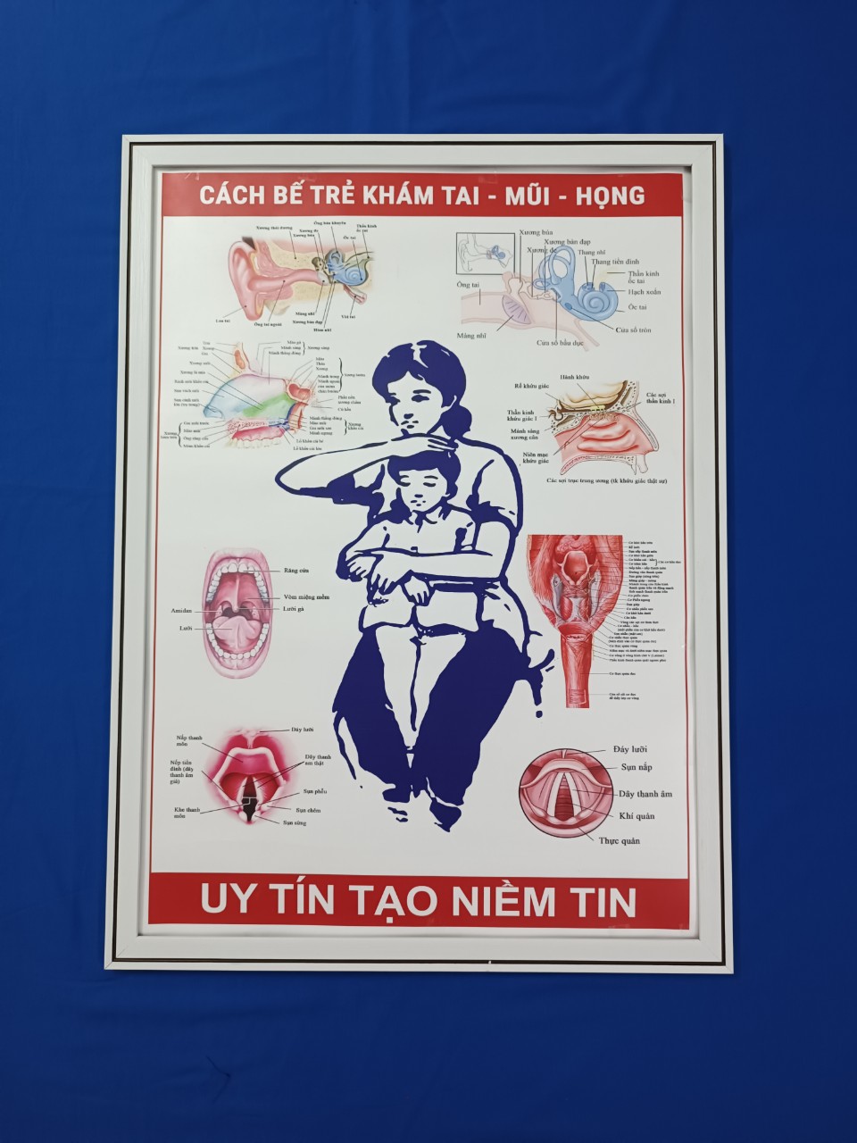 Tranh tráng gương cách bế trẻ khám tai-mũi-họng(kích thước 50cm.75cm)