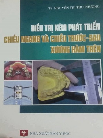 sach-dieu-tri-kem-phat-trien-chieu-ngang-va-truoc-sau