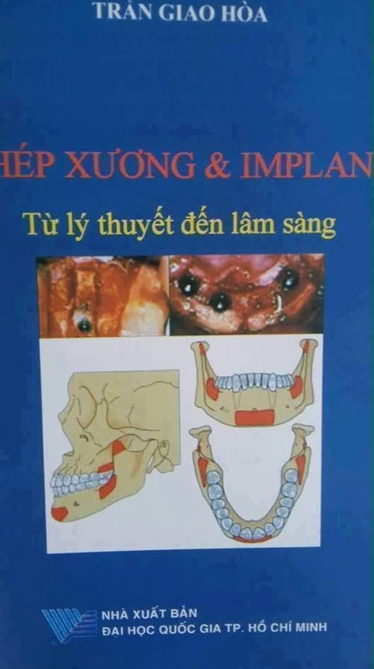 sach-ghep-xuong-implant-tu-ly-thuyet-den-lam-sang
