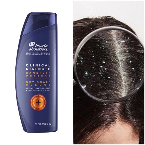 Dầu Gội Head & Shoulders USA