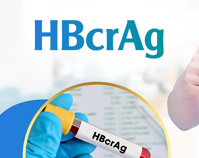 Marker HBcrAg đầy tiềm năng trong bệnh lý viêm gan B