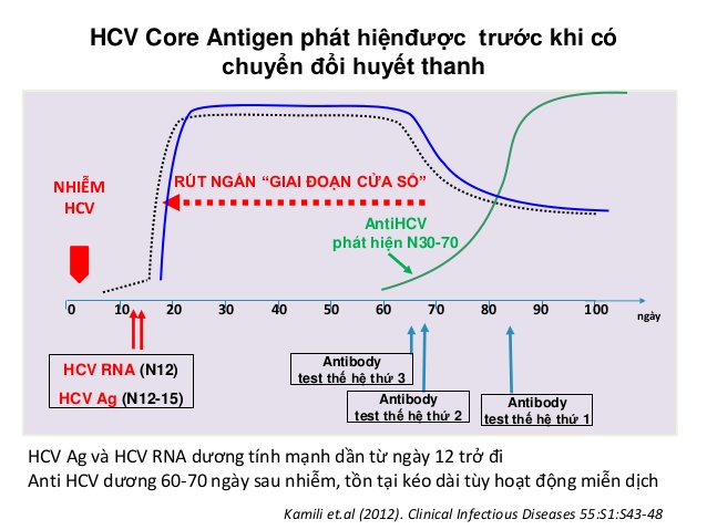 Giá trị HCVAg trong theo dõi và điều trị viêm gan C