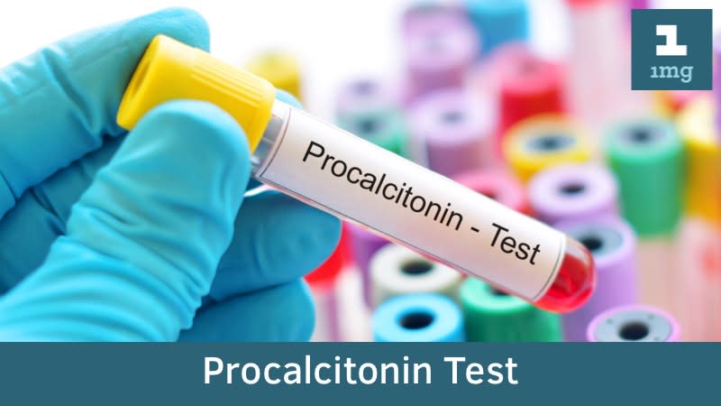 Xét nghiệm Procalcitonin (PCT) đánh giá tình trạng nhiễm khuẩn