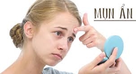Mụn ẩn - Cách chăm sóc và điều trị mụn ẩn.