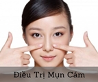 Mụn cám - Cách chăm sóc và điều trị