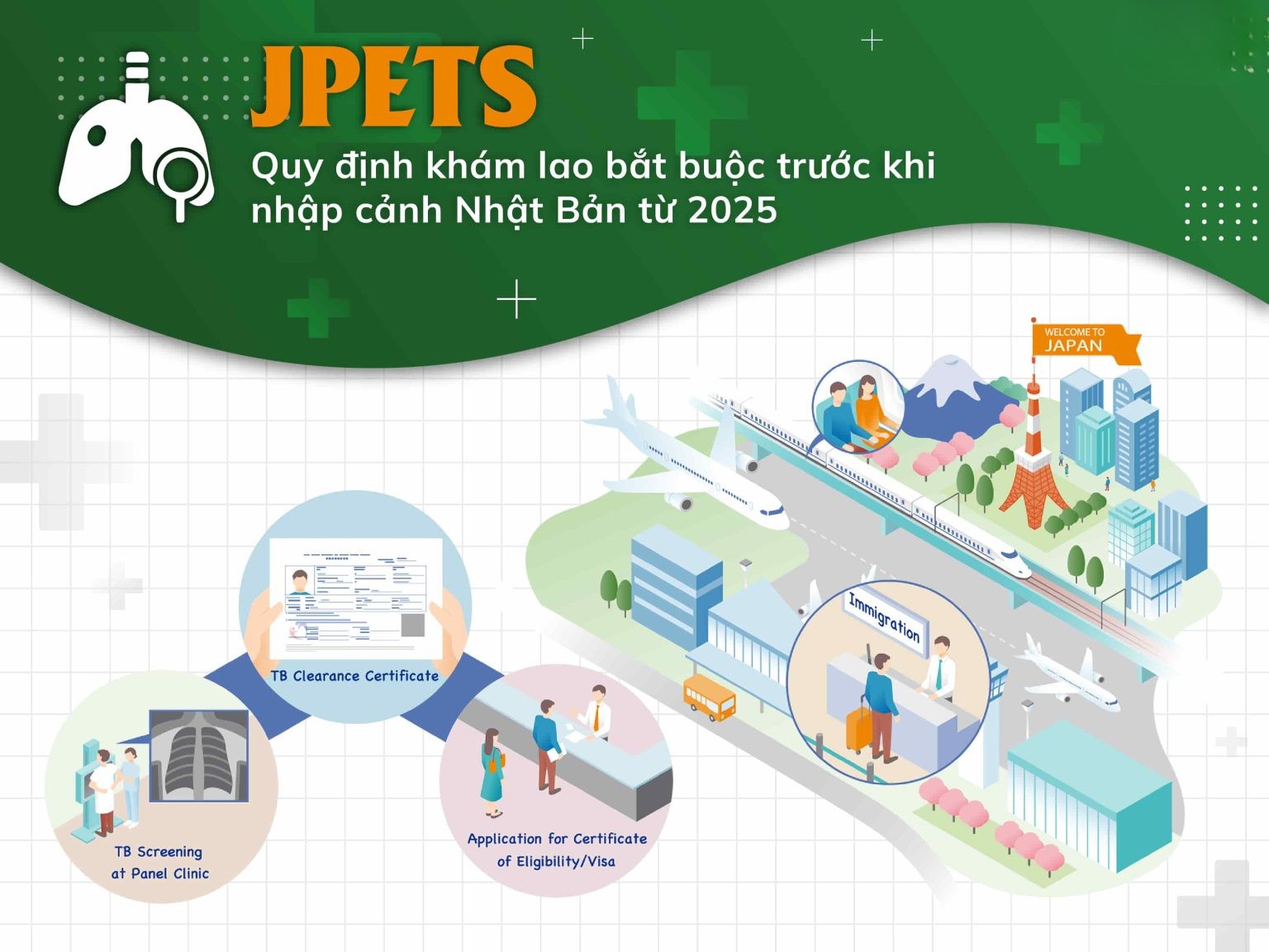 SÀNG LỌC BỆNH LAO TRƯỚC KHI NHẬP CẢNH NHẬT BẢN TỪ 2025