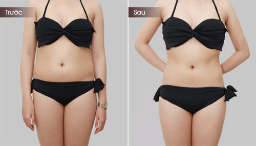 Bạn có đang giảm cân sai nguyên tắc?