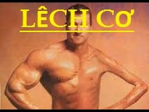 Tình trạng lệch cơ trong tập luyện thể hình