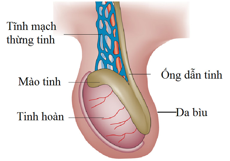 Giãn tĩnh mạch thừng tinh - Nguyên nhân triệu chứng, cách phòng và điều trị