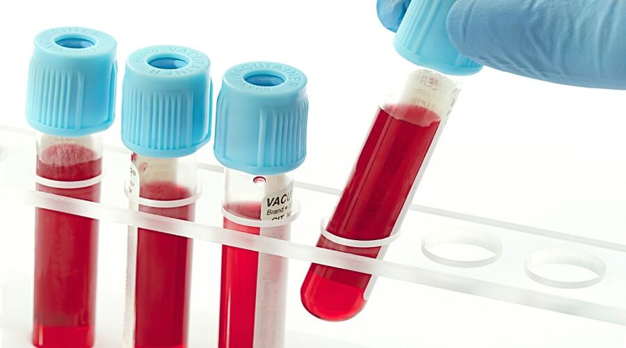  3 điều dưới đây có thể là nguyên nhân khiến bạn bị tăng đường huyết.