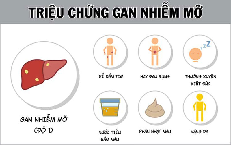 Gan nhiễm mỡ độ 1 có được coi là mức độ nguy hiểm không? Tìm hiểu ngay để biết