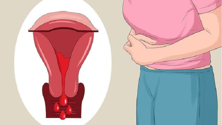 Top 6 dấu hiệu cảnh báo viêm nhiễm âm đạo chị em cần đặc biệt chú ý