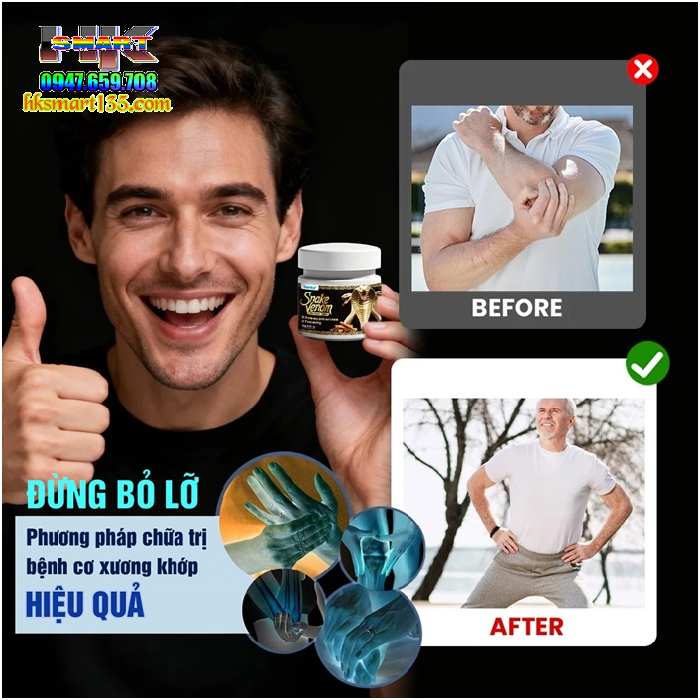 Cao Xoa Bóp Nọc Rắn Đen Snake Venom Sumifun 20gr- Giảm Đau Hỗ Trợ Mọi Vấn Đề Về Cơ Xương Khớp