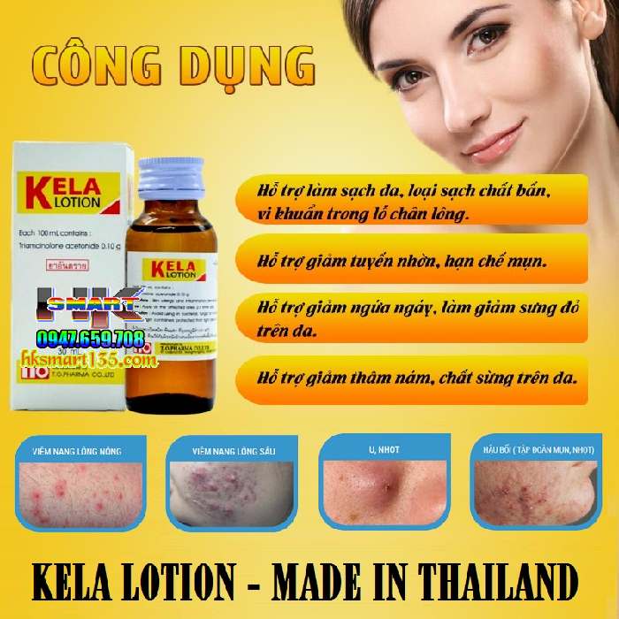 Dưỡng thể đặc trị viêm lỗ chân lông Kela Lotion