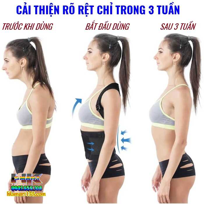 Đai chống gù lưng- cong vẹo cột sống