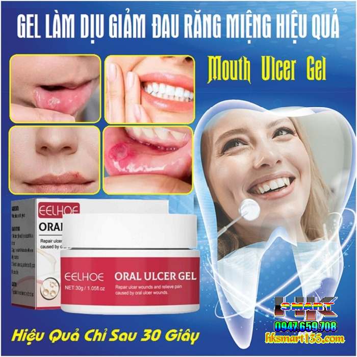 Gel Làm Dịu Giảm Đau Răng Miệng Mouth Oral Ulcer 30gr
