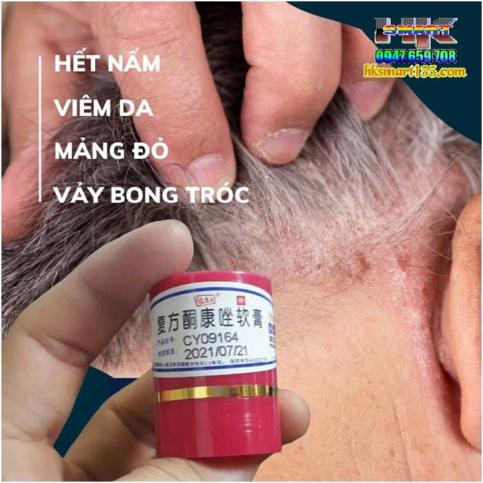 Kem Bôi Nội Địa Trung Hộp Đỏ 7gr- Đặc Trị Mọi Loại Nấm Ngứa Lang Ben