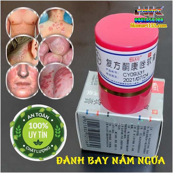 Kem Bôi Nội Địa Trung Hộp Đỏ 7gr- Đặc Trị Mọi Loại Nấm Ngứa Lang Ben