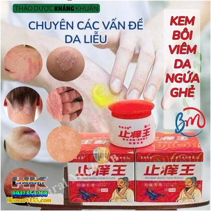 Hộp Đỏ Kem Bôi Bọ Cạp Thần Y Đặc Trị Các Bệnh Ngoài Da
