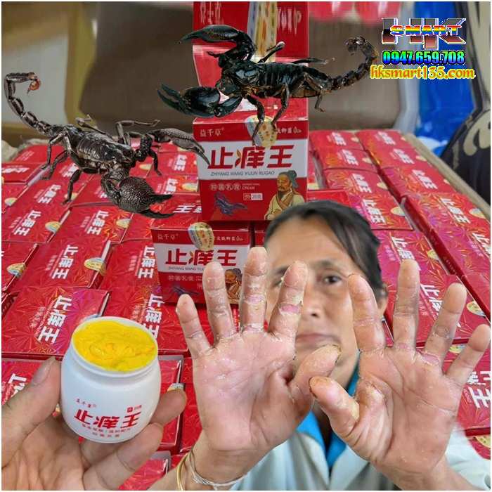 Hộp Đỏ Kem Bôi Bọ Cạp Thần Y Đặc Trị Các Bệnh Ngoài Da