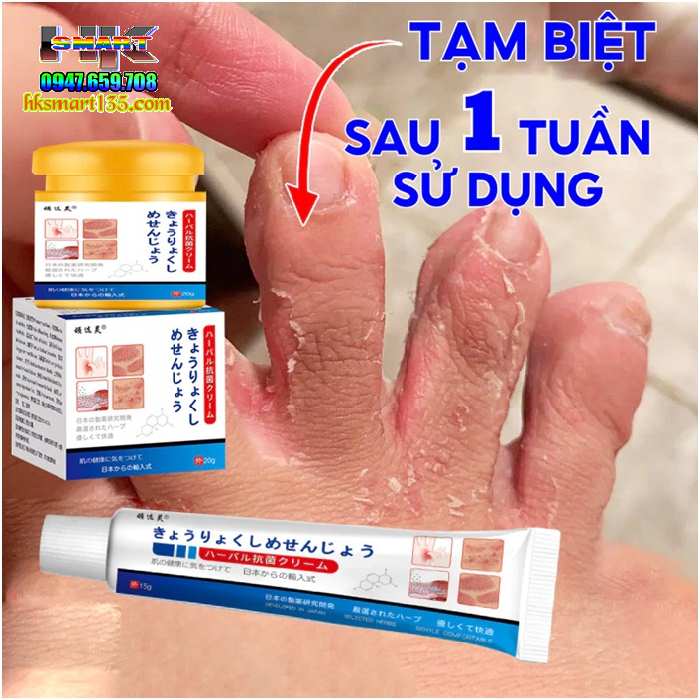 Combo Kem bôi đặc trị và ngừa tái phát nấm ngứa á sừng vảy nến Nhật Bản