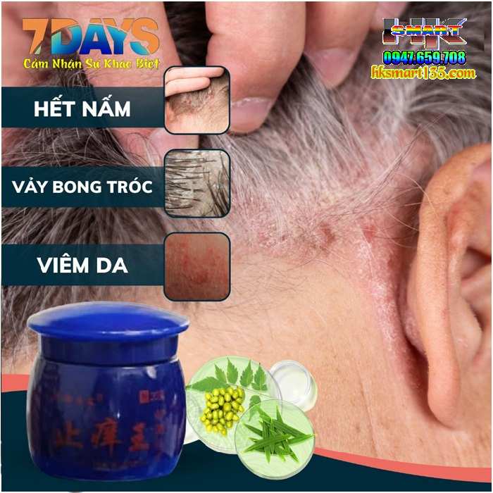 Hộp Xanh Kem Bôi Bọ Cạp Thần Y Đặc Trị Các Bệnh Ngoài Da