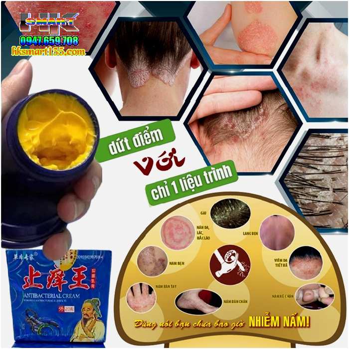 Hộp Xanh Kem Bôi Bọ Cạp Thần Y Đặc Trị Các Bệnh Ngoài Da