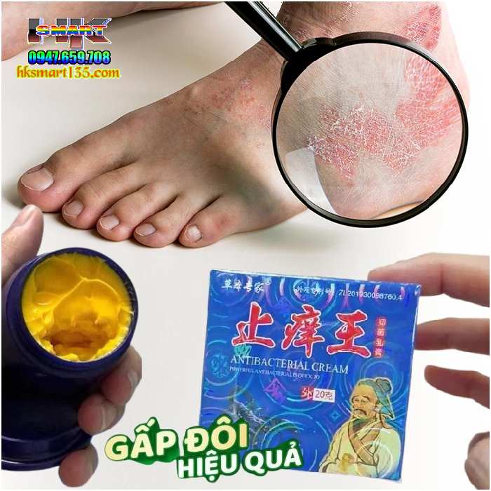 Hộp Xanh Kem Bôi Bọ Cạp Thần Y Đặc Trị Các Bệnh Ngoài Da