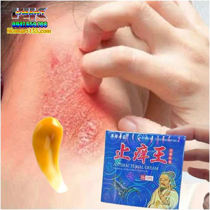 Hộp Xanh Kem Bôi Bọ Cạp Thần Y Đặc Trị Các Bệnh Ngoài Da