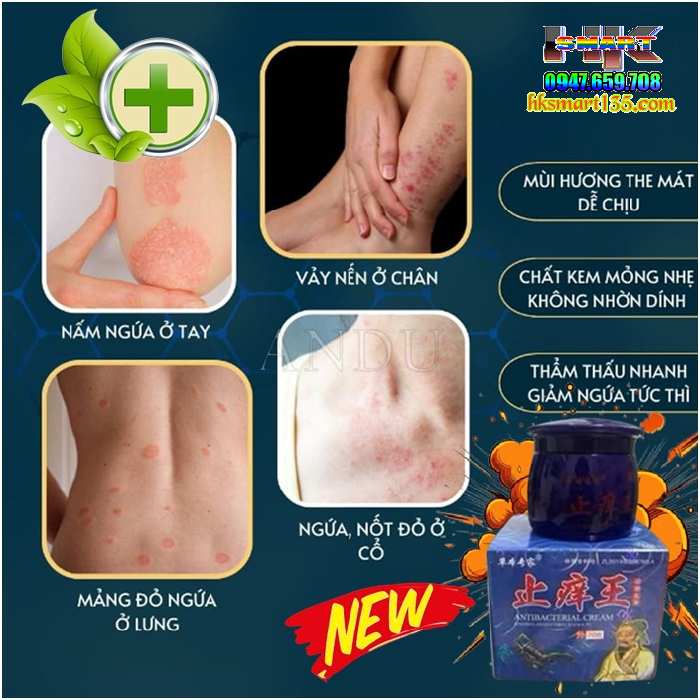 Hộp Xanh Kem Bôi Bọ Cạp Thần Y Đặc Trị Các Bệnh Ngoài Da