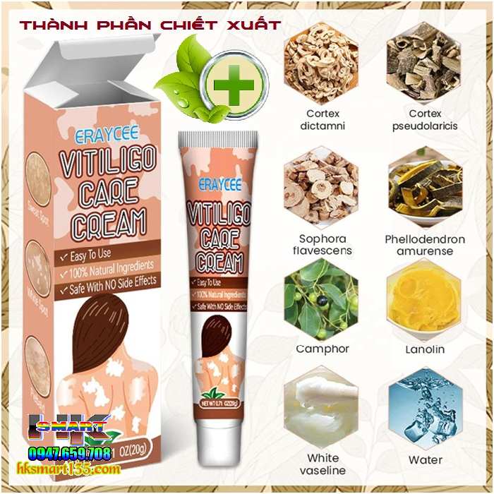 Kem bôi bạch biến lang ben Vitiligo ERAY CEE- 20gr làm mờ bạch biến đốm trắng