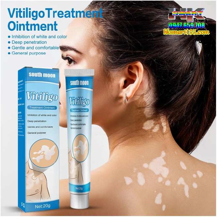 Kem Bôi Bạch Biến Lang Ben Vitiligo South Moon-20gr- Trị Mờ Bạch Biến Đốm Trắng Nám Thâm Hiệu Quả