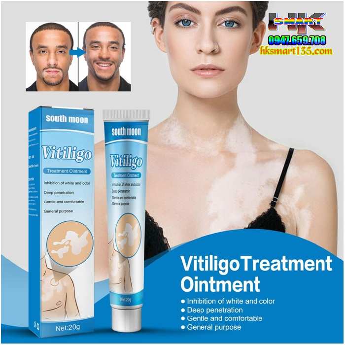 Kem Bôi Bạch Biến Lang Ben Vitiligo South Moon-20gr- Trị Mờ Bạch Biến Đốm Trắng Nám Thâm Hiệu Quả