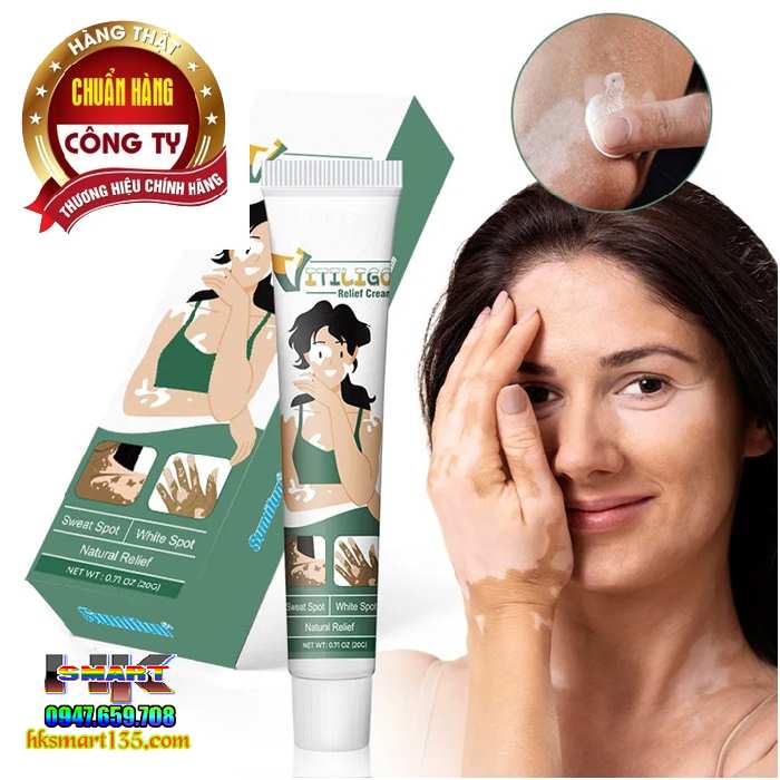 Kem Bôi Bạch Biến Lang Ben Vitiligo South Moon-20gr- Trị Mờ Bạch Biến Đốm Trắng Nám Thâm Hiệu Quả