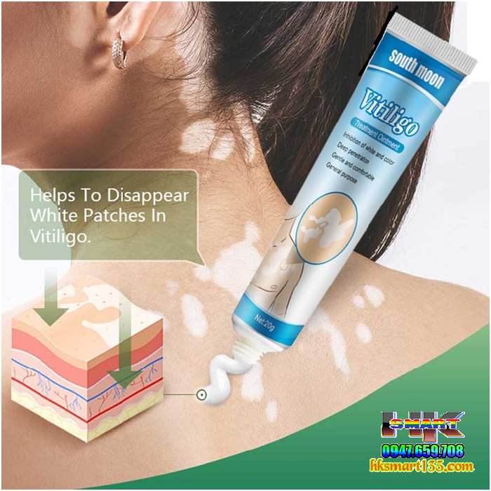 Kem Bôi Bạch Biến Lang Ben Vitiligo South Moon-20gr- Trị Mờ Bạch Biến Đốm Trắng Nám Thâm Hiệu Quả
